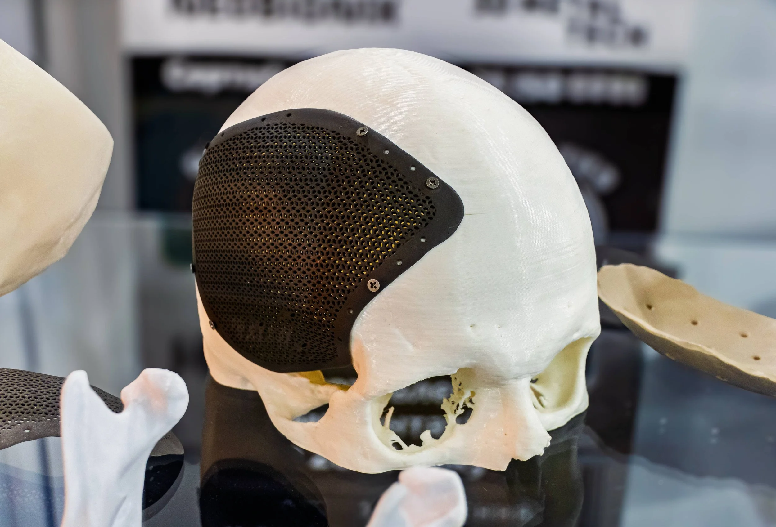 Point-of-Care Implant Clearance Sets a New Manufacturing Benchmark