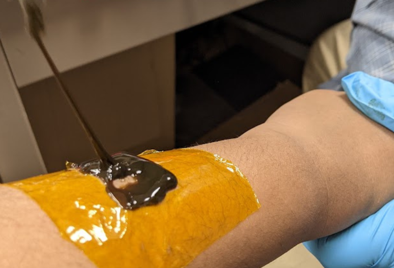 3D-printable hydrogel points to more adaptable wearable health sensors