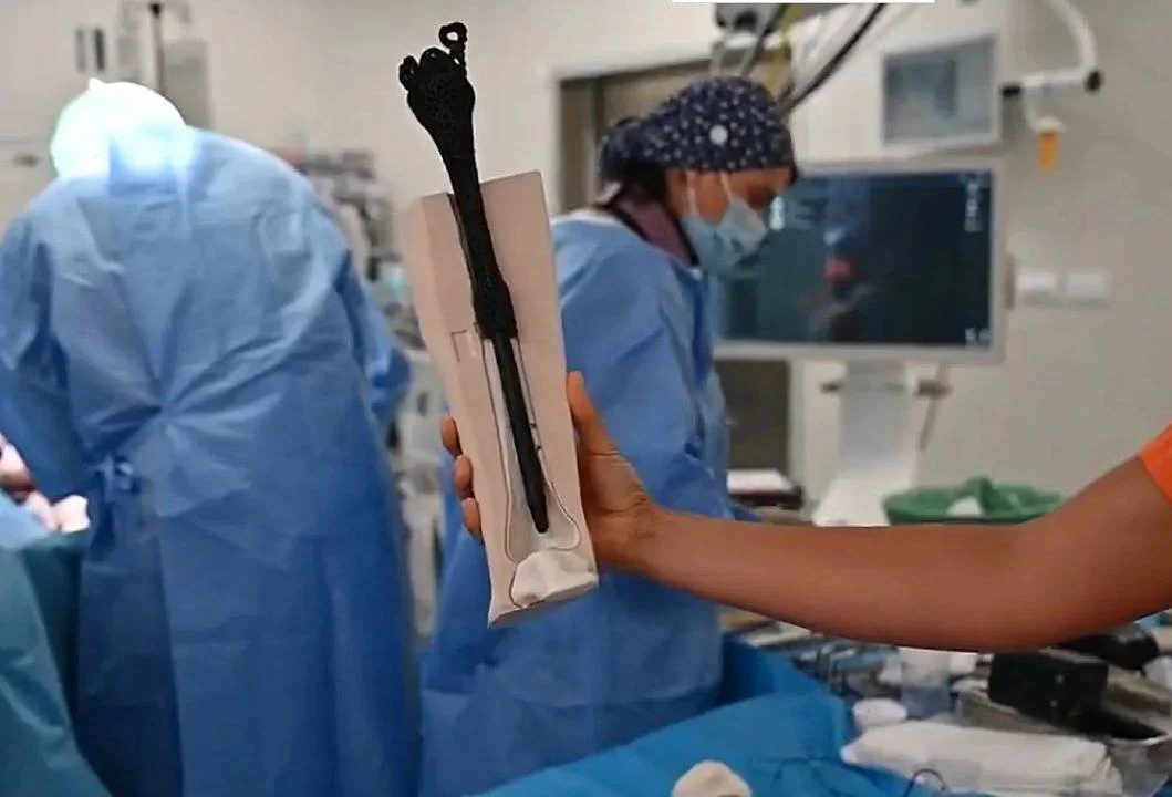 Personalised 3D-printed bone implant shows potential of advanced manufacturing in MedTech