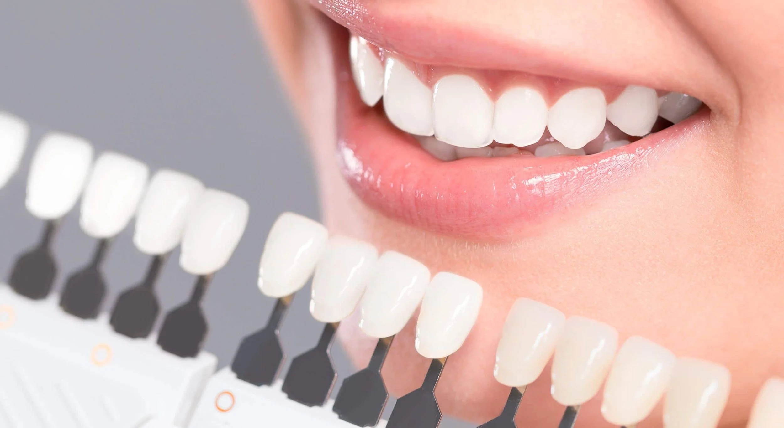 Un sourire avec des dents blanches, légèrement entrouvert, avec un échantillon de couleur de dentition à côté.