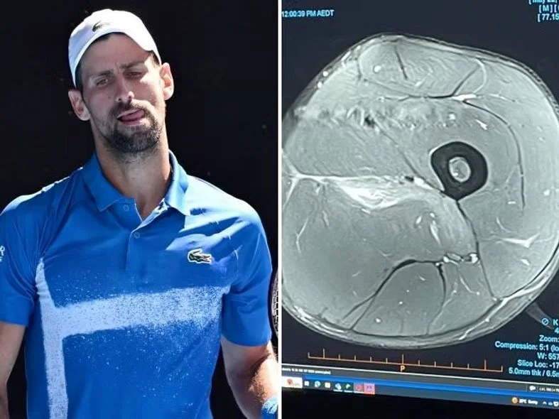 Il Ritiro di Djokovic agli Australian Open: cosa si nasconde dietro l'infortunio muscolare e come viene gestito nel tennis professionistico