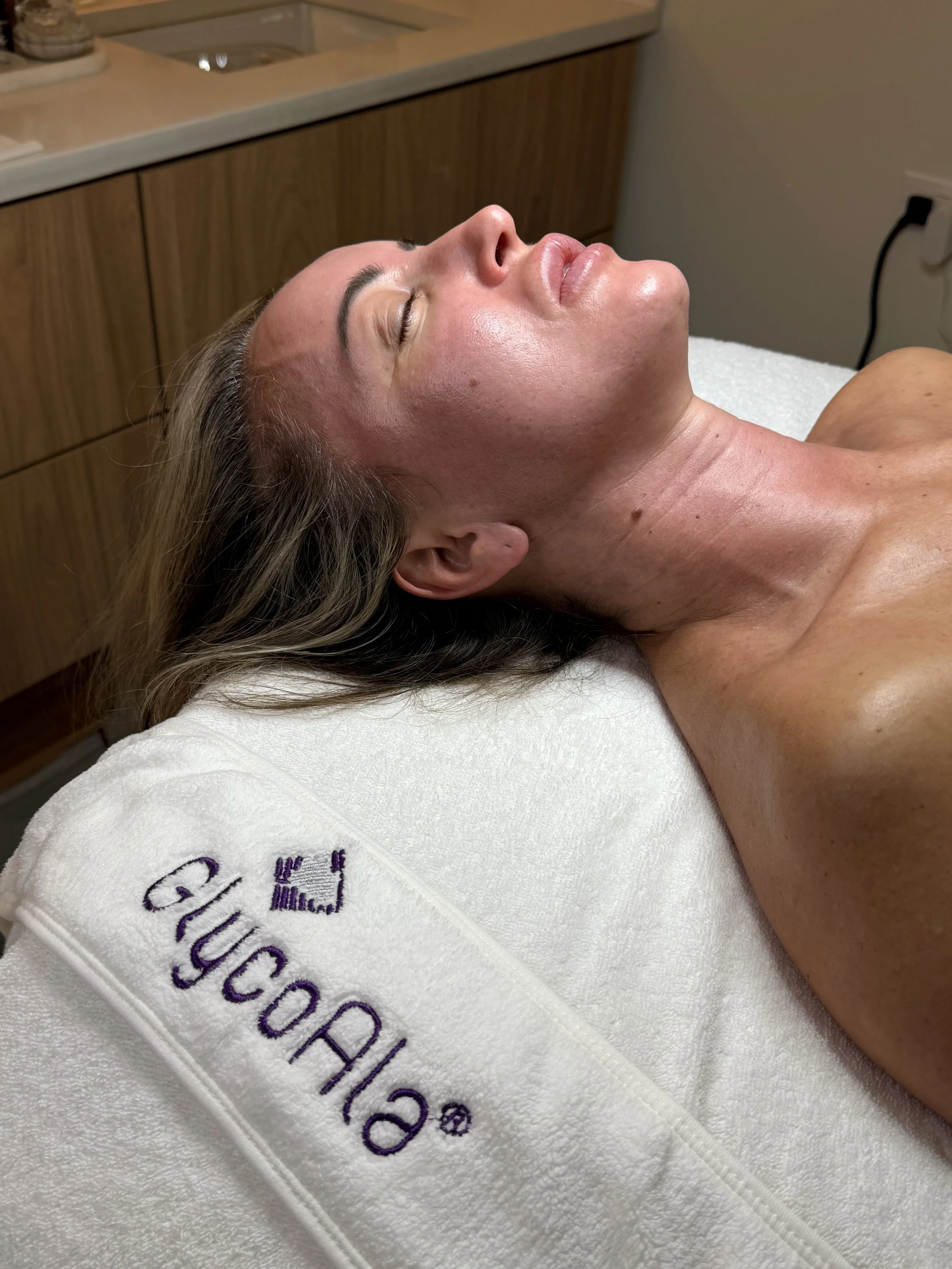A woman lying down with her eyes closed, having just received a facial at a spa or beauty salon. She is resting on a bed covered with a white towel embroidered in purple.