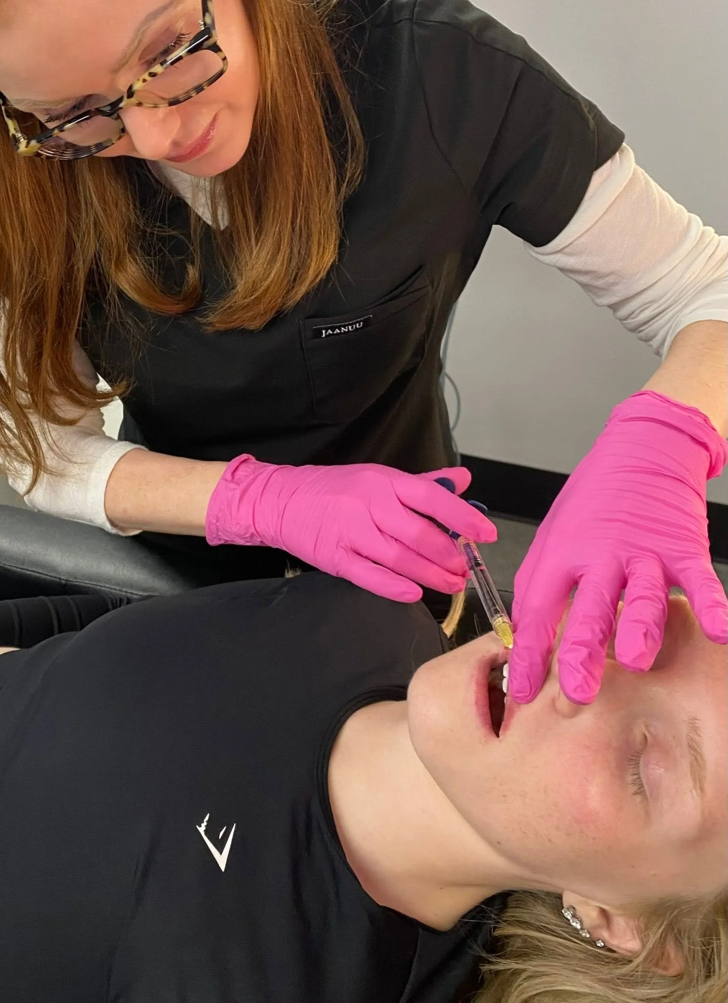 Lip enhancement procedure at Buff Aesthetics in Tiffin, OH
