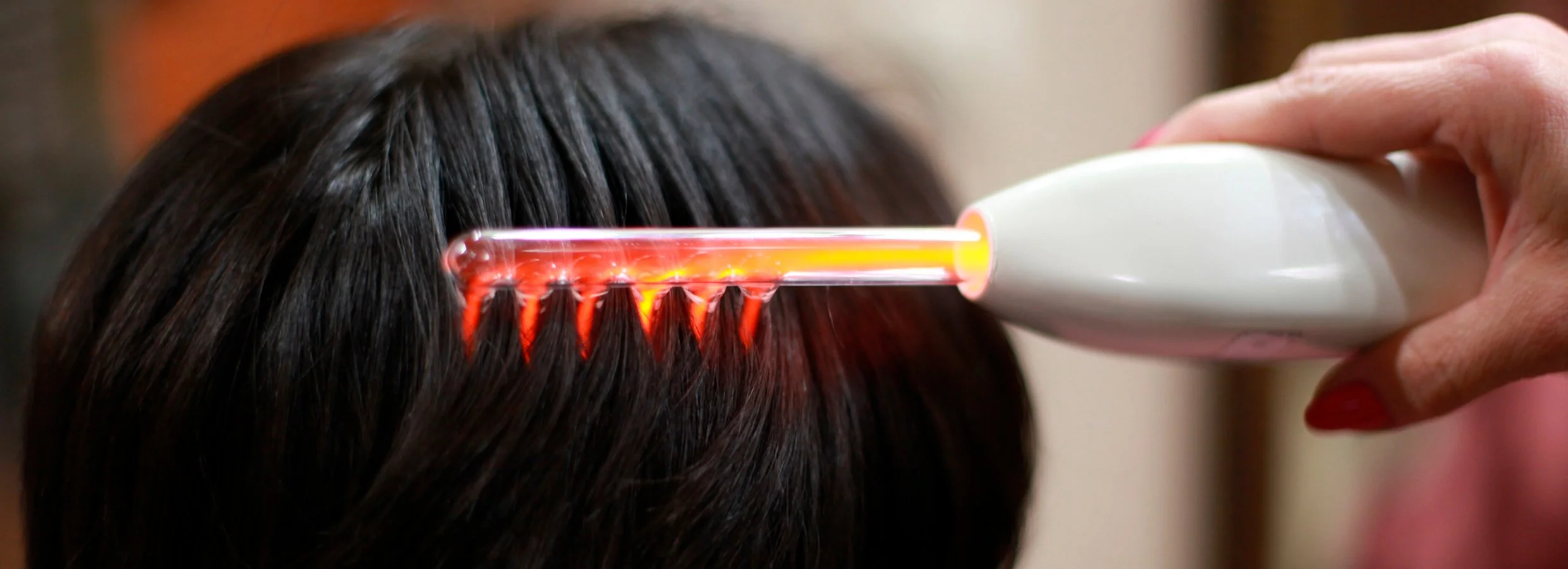 Close-up of a person's scalp receiving laser hair therapy with a handheld device emitting red light onto dark hair.