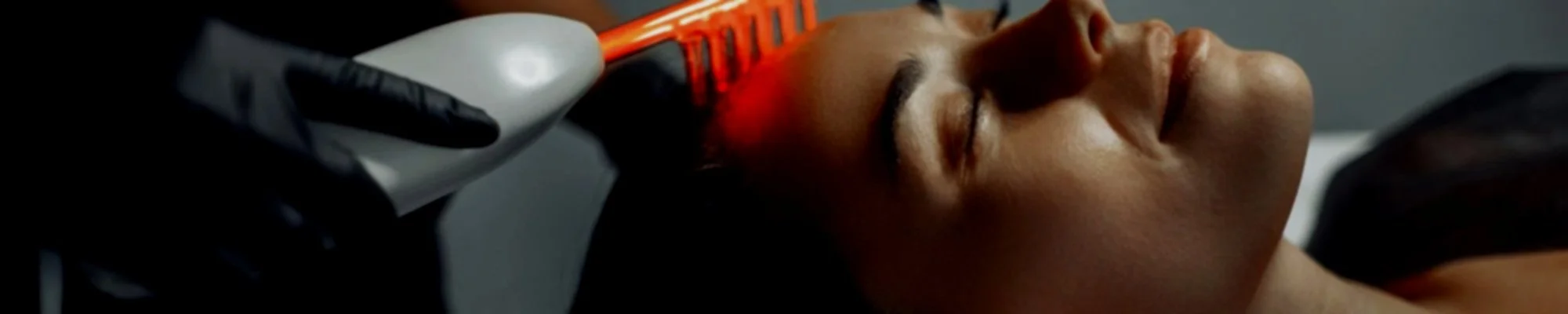 Close-up of a woman lying down with eyes closed, receiving a laser treatment on her forehead from a medical professional wearing black gloves.