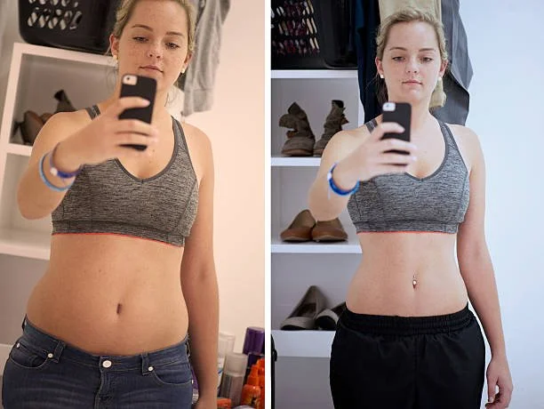Before and After Photos: A Cultural Obsession