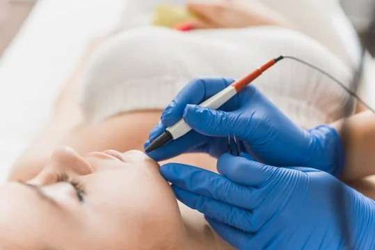 Electrolysis vs IPL/Laser for unwanted facial hair: What’s the real difference?