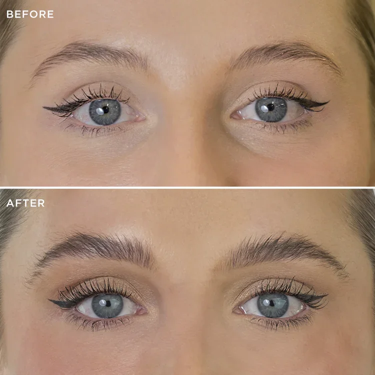 brow-code_multi-peptide-growth-serum_before-after__bg_02_750x.webp