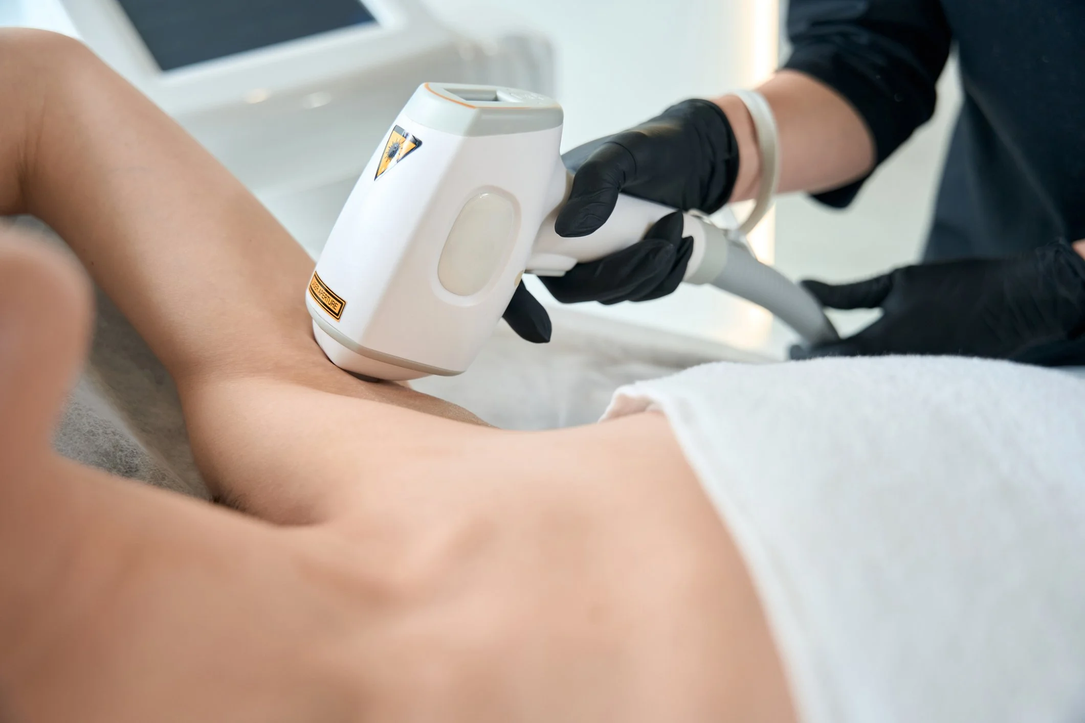 A medical professional using a laser hair removal device on a patient's underarm in a clinical setting. Treatment done by a registered Nurse certified in advanced lasers
