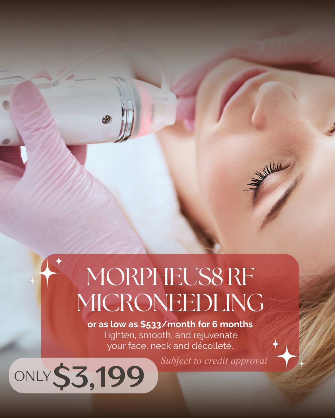 A woman receiving Morpheus RF microneedling treatment on her face, with a healthcare professional in pink gloves administering the procedure.