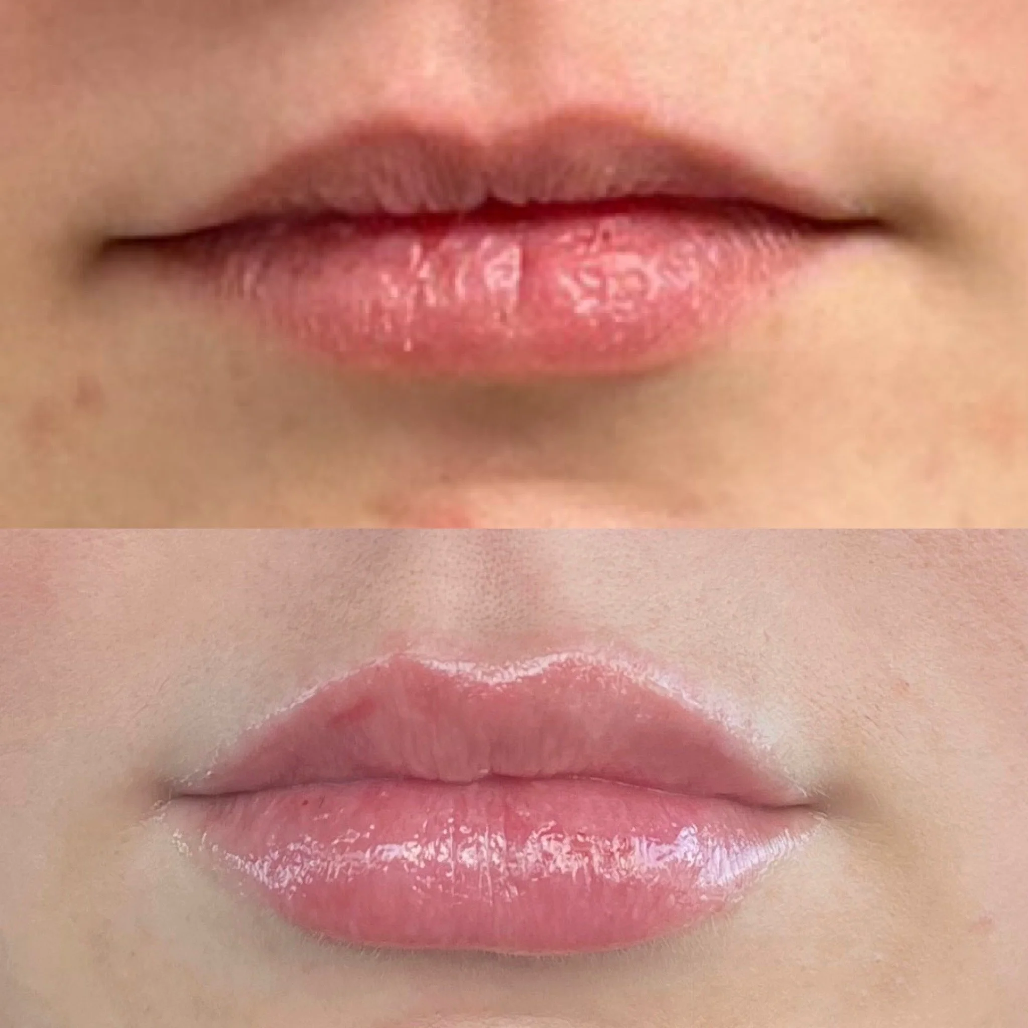 Close-up of a person's lips, showing a before and after comparison of lip gloss application.