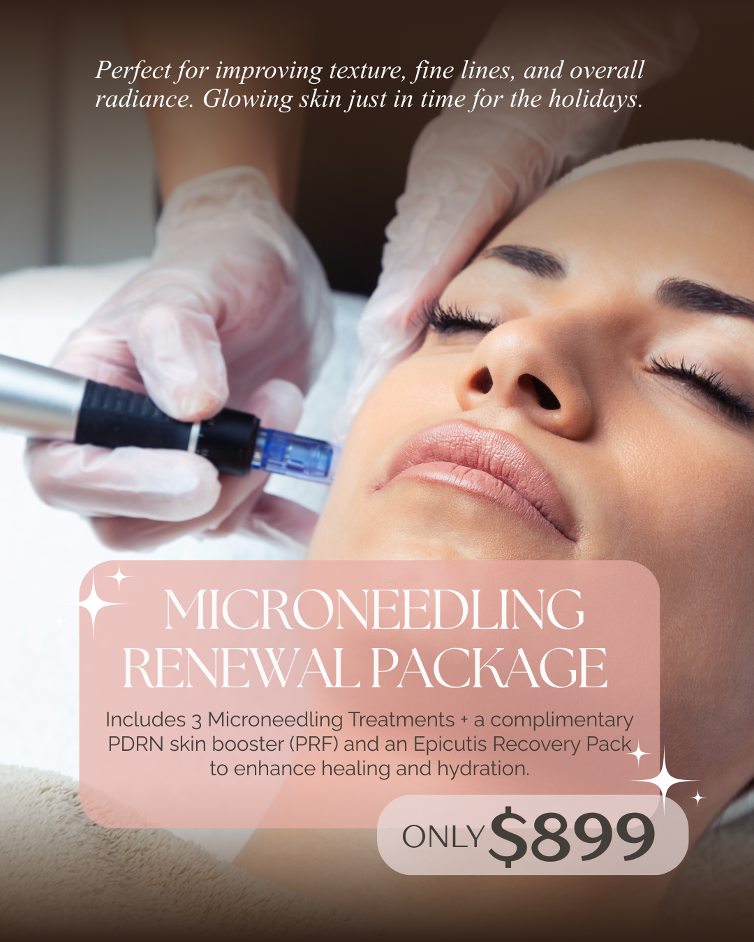 A woman receiving a microneedling treatment on her face in a spa setting, with text overlay advertising a microneedling renewal package for $899.