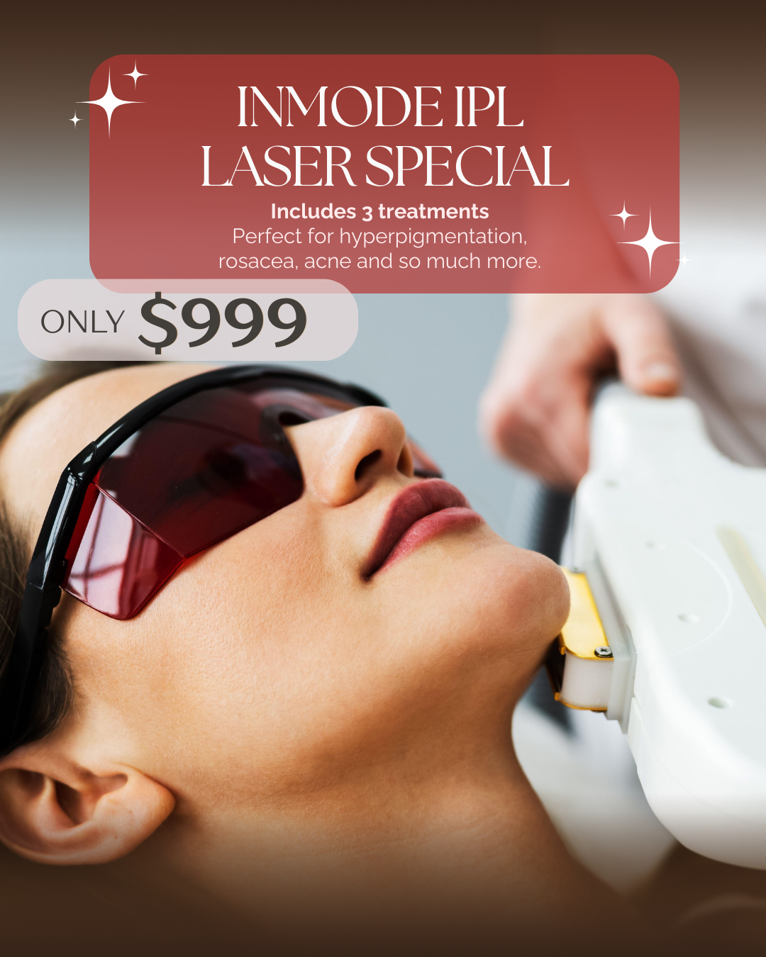 A woman receiving laser skin treatment while wearing protective goggles, with promotional text overlay advertising a laser special for $999.