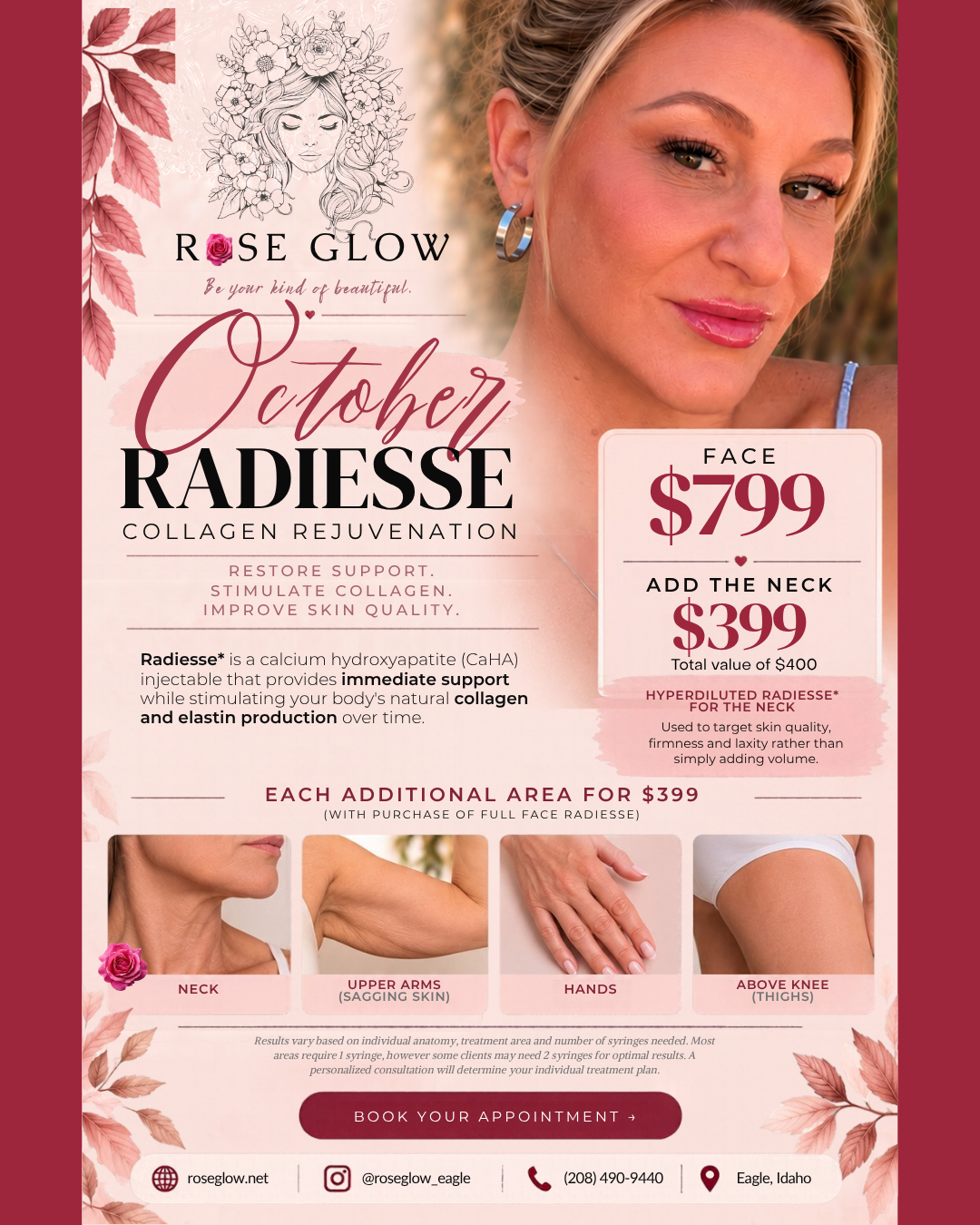 radiesse-collagen-biostimulator-special-eagle-idaho.png