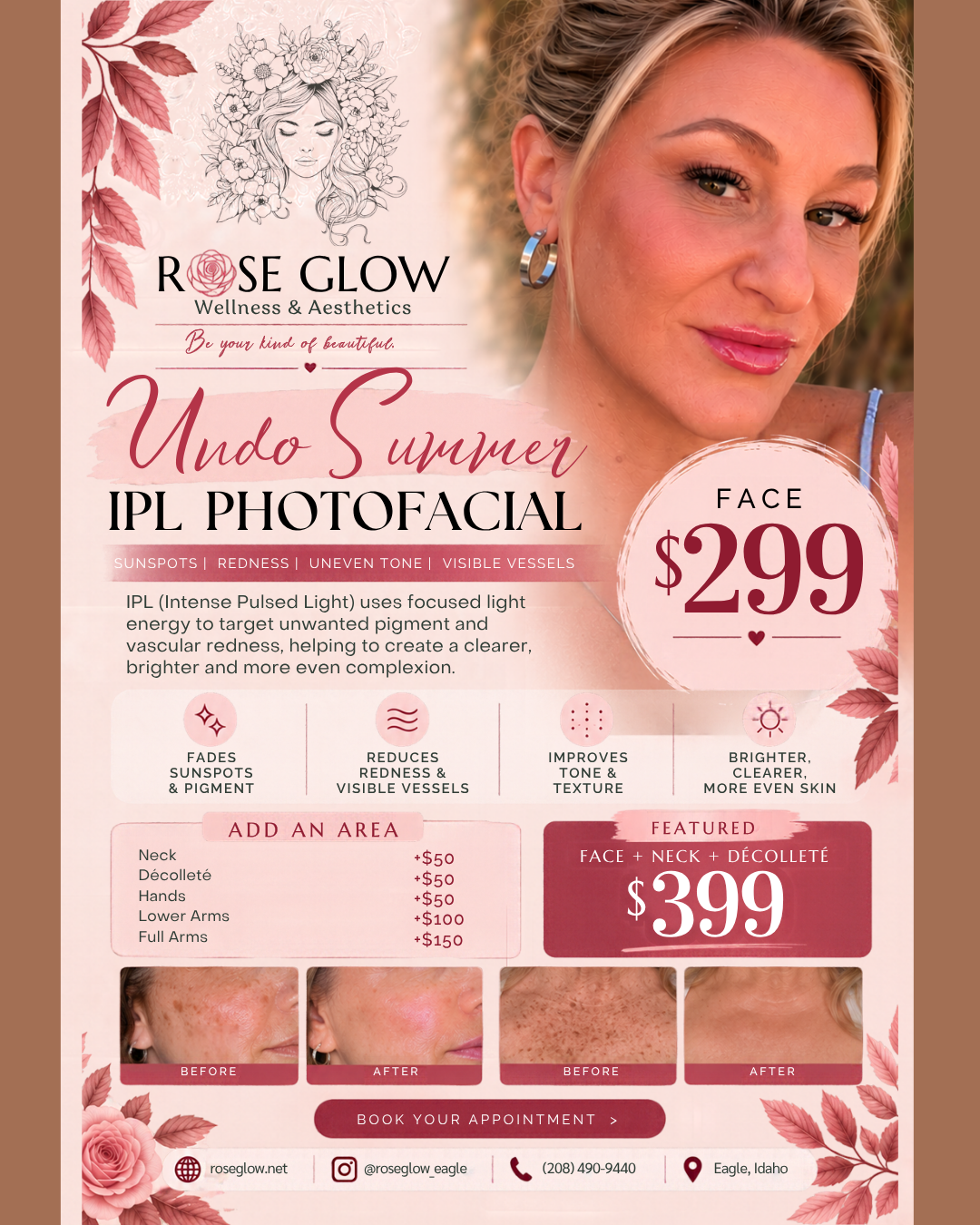 ipl-photofacial-october-special-eagle-idaho.png