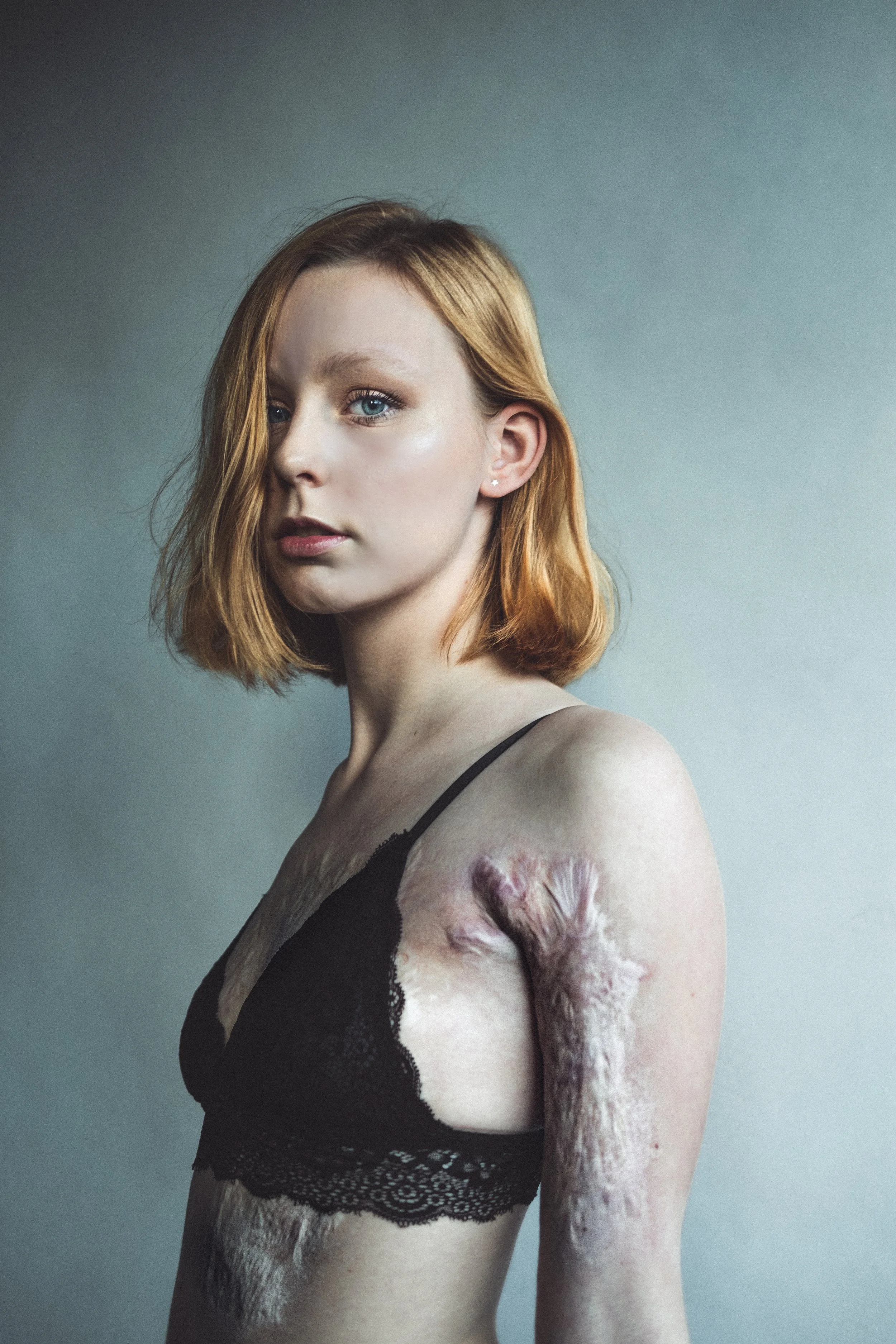 Pip - 3301 - Burn survivor.jpg