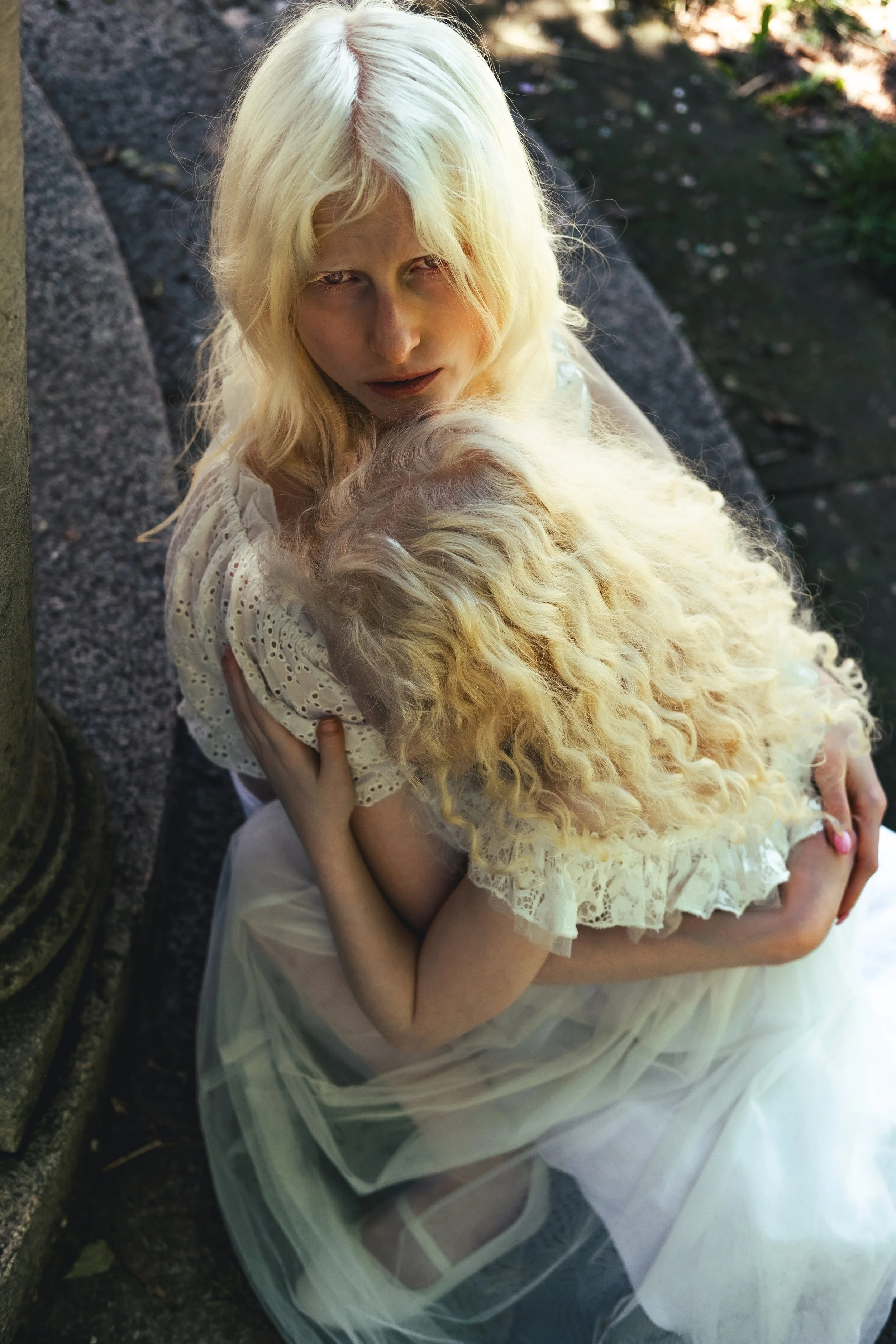 albinismPIP-15 copy.jpg