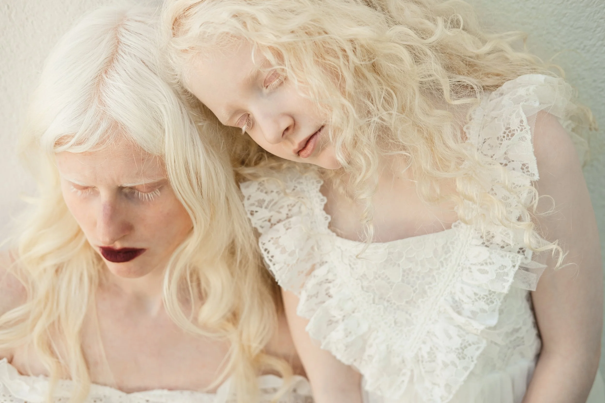 albinismPIP-19.jpg