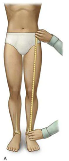 Image courtesy of musculoskeletalkey.com