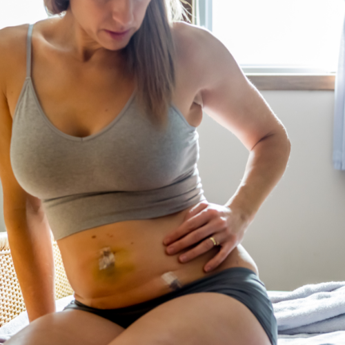 A woman sitting on a bed with her hand on her stomach, which has bandages on it, in a brightly lit room.