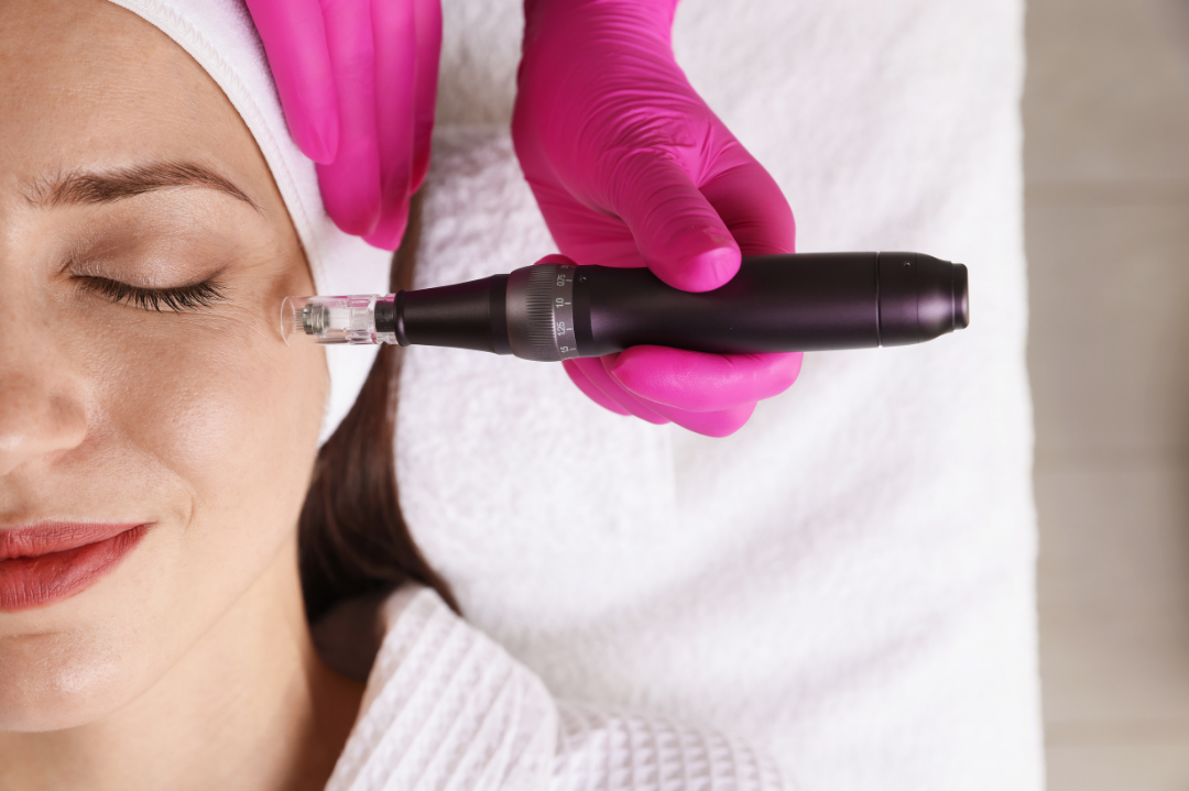 Medspa in Redlands, CA, 92373 | Microneedling Near Me