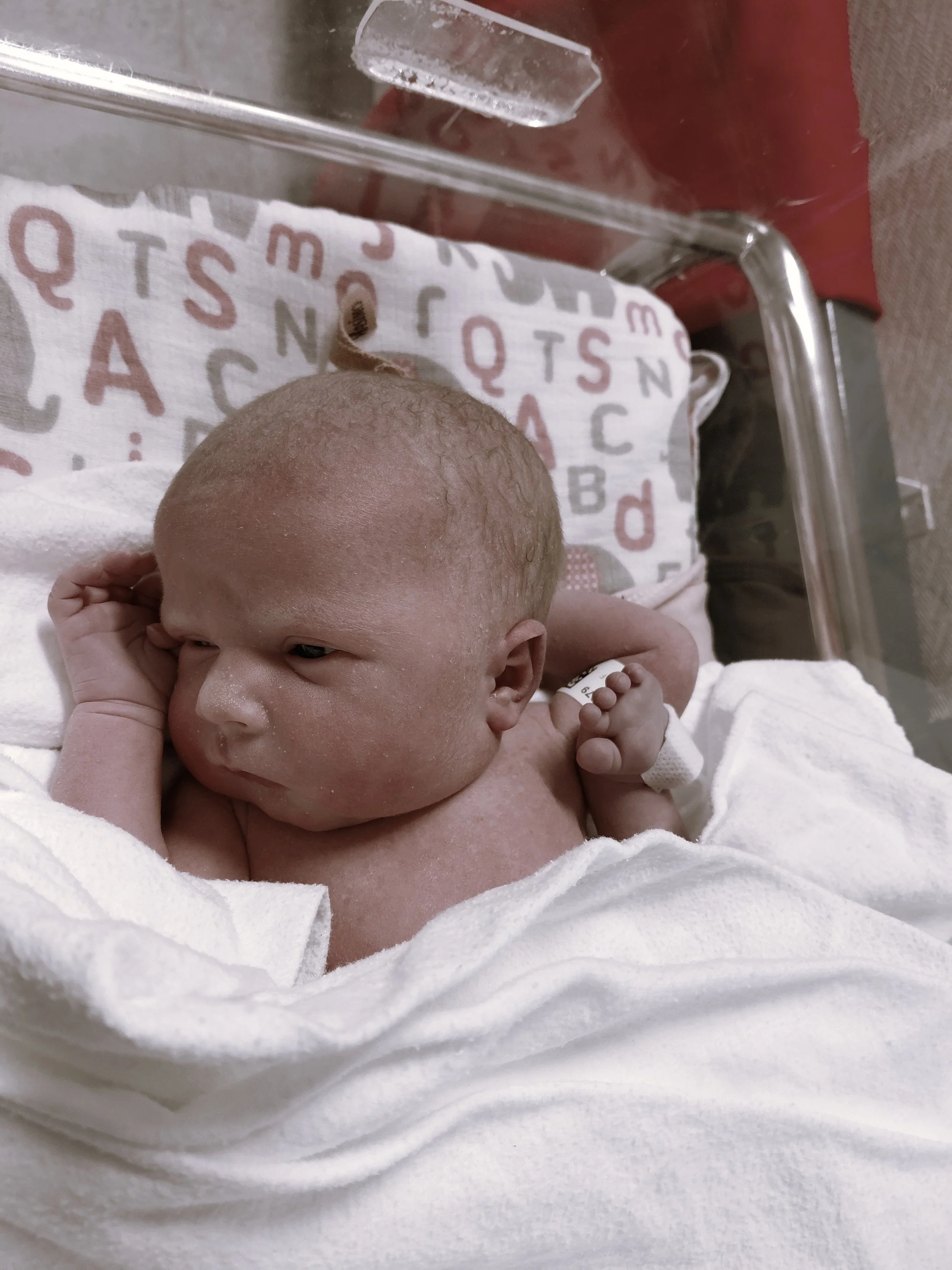 https://www.google.com/search?q=can%20arthrogryposis%20be%20detected%20before%20birth