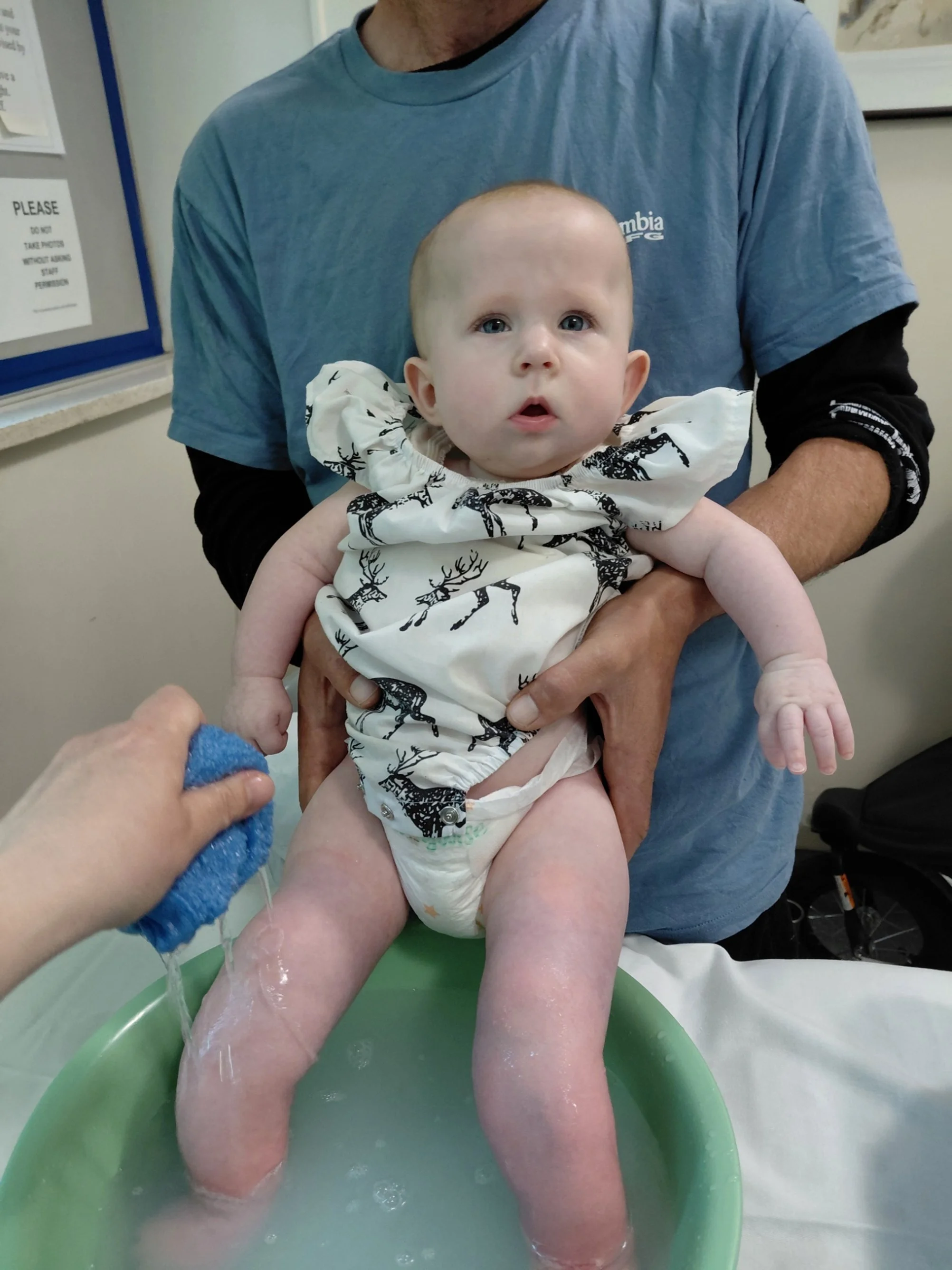 hannah-rose getting washed down after casts removed