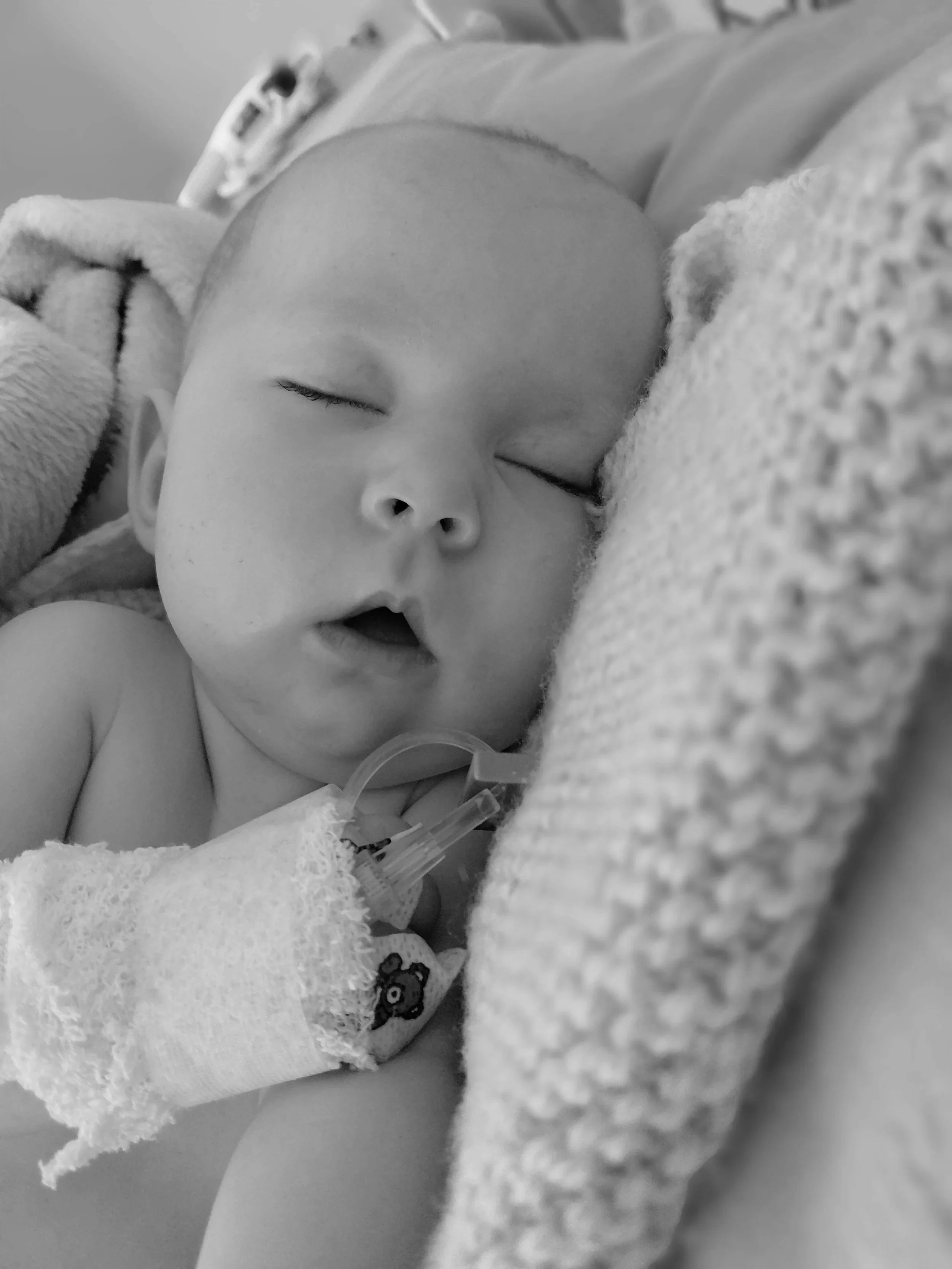 Adjusting after surgery.