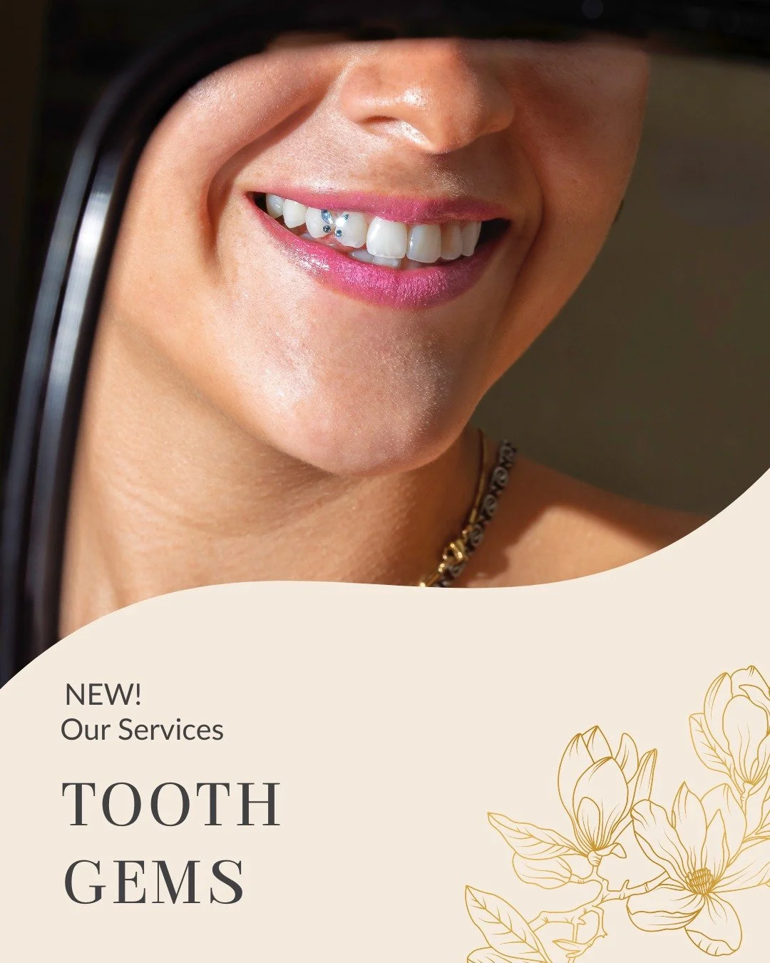 Introducing our new Tooth Gems service. 

Now available at our Invercargill Indulgence Lounge, this is a sparkling smile-upgrade. Tiny crystals or gold charms are gently bonded to the front surface of your tooth using dental-safe adhesive and no dril