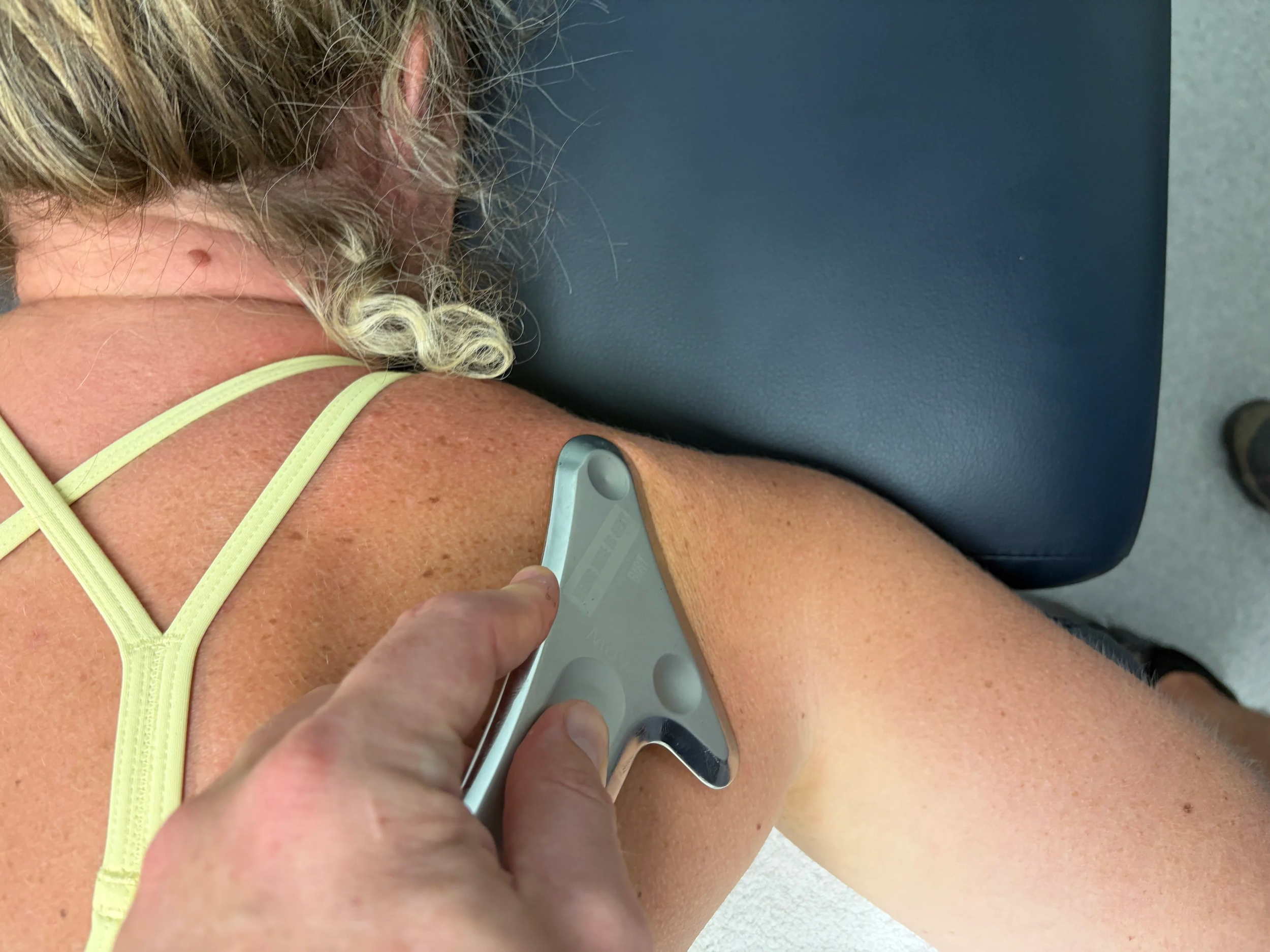 Instrument assisted soft tissue manipluation (IASTM) for shoulder pain, neck pain, headaches at FPS Physiotherapy, Elsternwick.