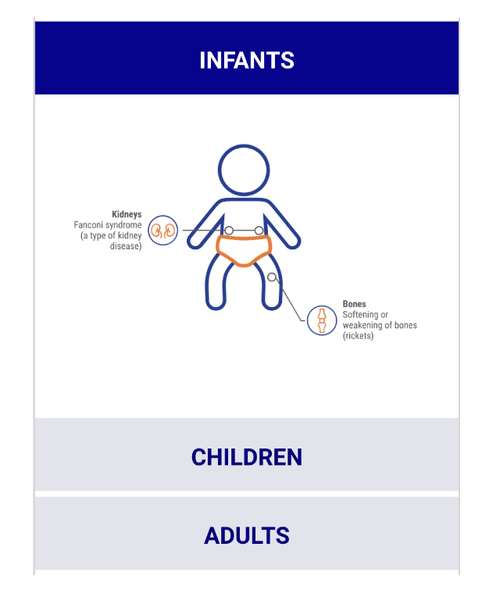 Diagram of infant health issues, highlighting kidneys affected by Fanconi syndrome and bones with softened or weakened structure.