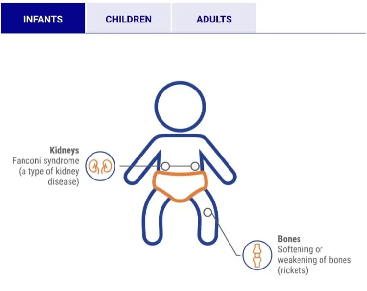 Diagram of a child highlighting health issues related to kidneys, including Fanconi syndrome, and bones, including weakening or ricketts.
