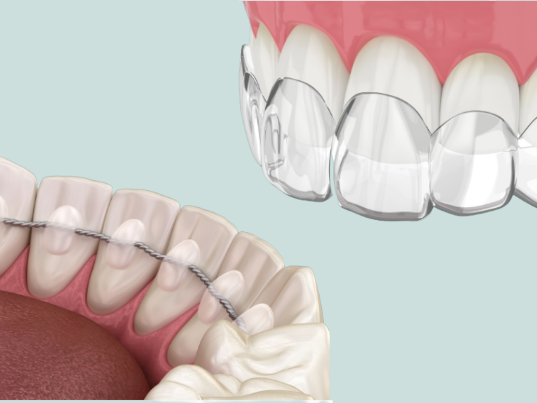 Patient Resources | Discover Your Smile Journey Today — Unley Orthodontics