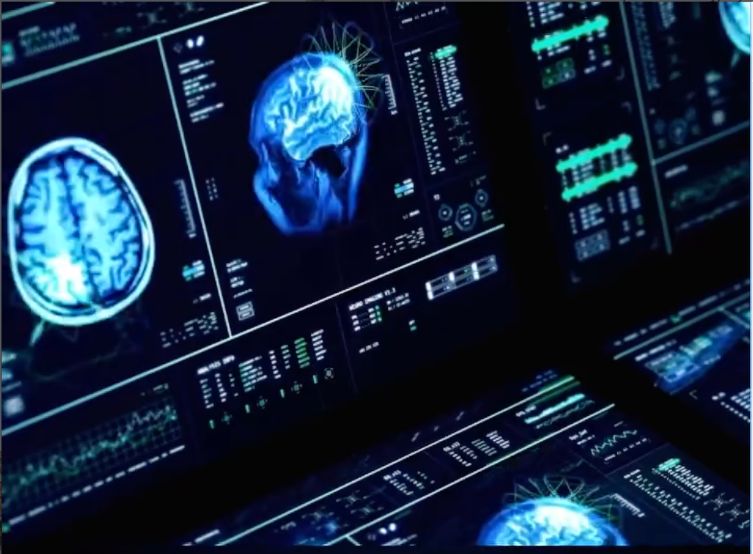 Creatine - What It’s Doing To Your Brain