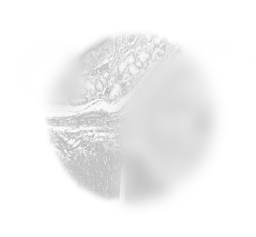 A blurred, grayscale image with indistinct shapes and textures.