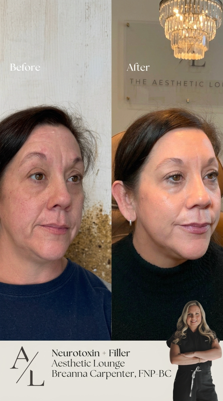 Side-by-side comparison of a woman's face showing before and after skincare treatment, highlighting improvements in skin clarity, texture, and appearance.