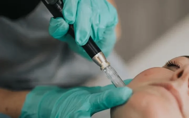 Client undergoing a skin booster treatment to improve hydration and radiance.