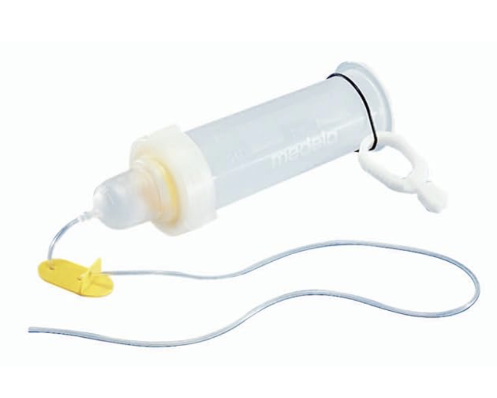 The Supplemental Nursing System (SNS): Feeding at the Breast When More Is Needed