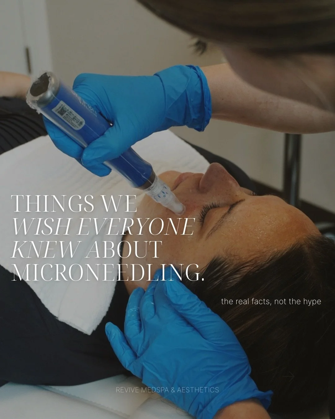 Microneedling is one of the most misunderstood treatments out there &mdash; so let&rsquo;s clear the air.

From pain levels to timelines to what actually creates collagen, these are the things we wish everyone knew before booking.

If you&rsquo;re th