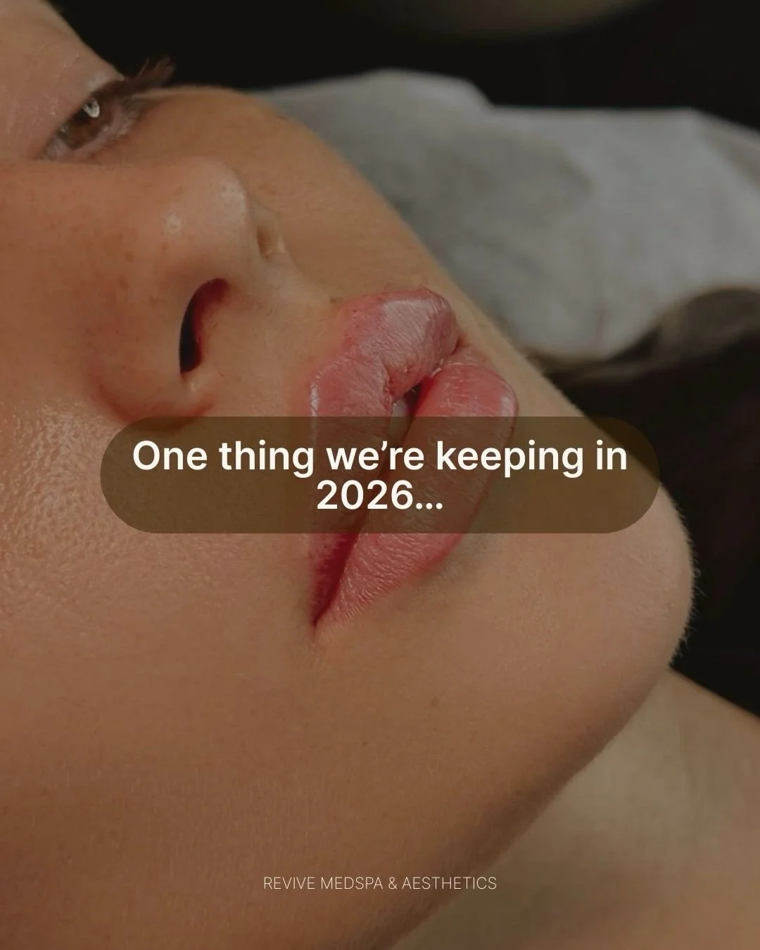 One thing we&rsquo;re keeping in 2026&hellip; beautiful natural-looking lips 👄 with a little boost 💦😏

#lipfiller #lipinjections #naturalbeauty #medicalaesthetics💉