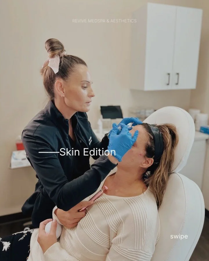 This Valentine&rsquo;s Day, choose treatments that actually love you back.
Because your face deserves a healthy relationship 💋
✨ Book your consultation &mdash; link in bio

#medspalife #skintreatments #skinconfidence #skinhealth #fallriverma