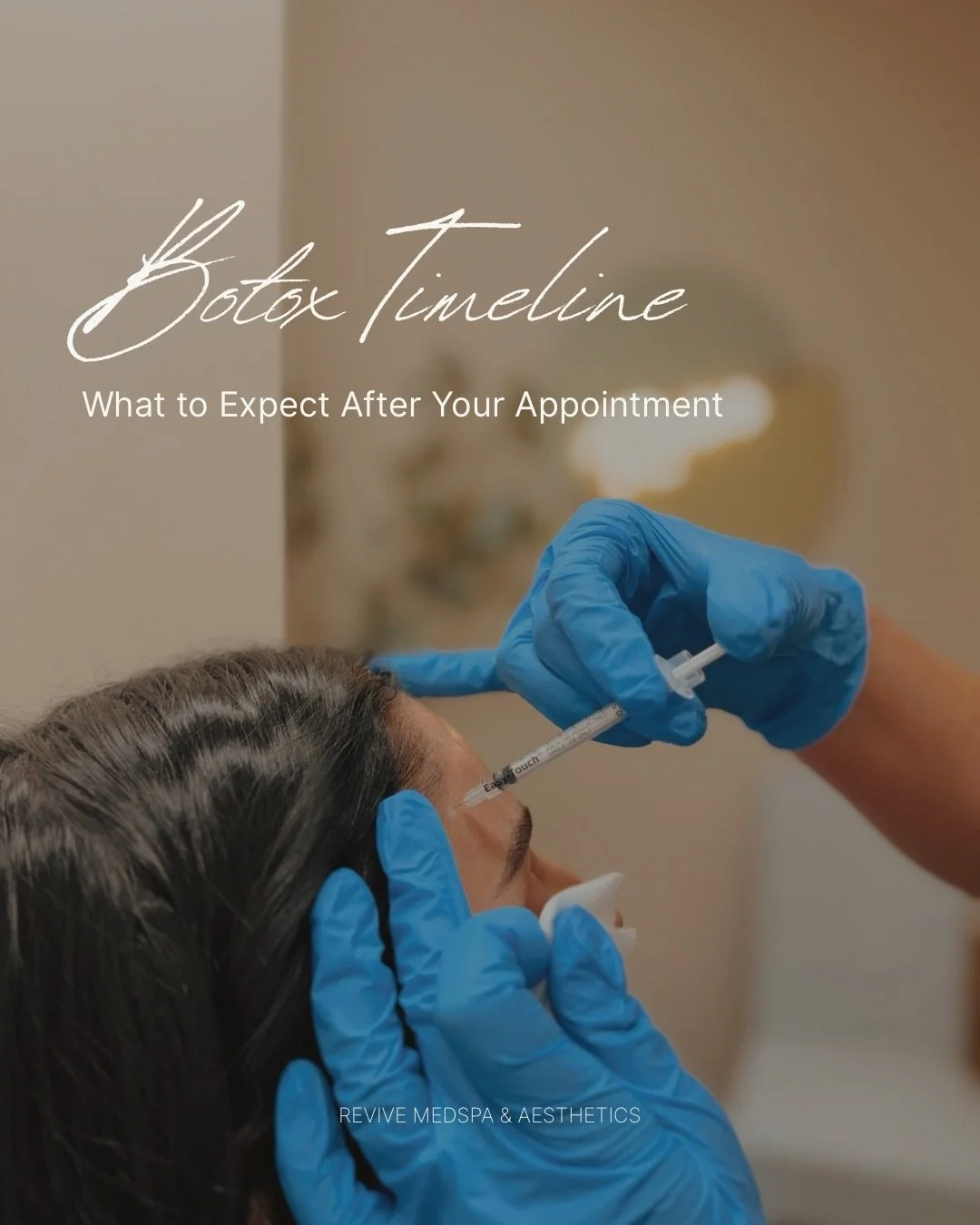 The key to perfect timing? Planning ahead.

Book your Botox appointment now so your results are ready exactly when you need them ✨

#medicalaesthetics #injectorlife #botoxtreatment #wrinklefreeskin #fallriverma