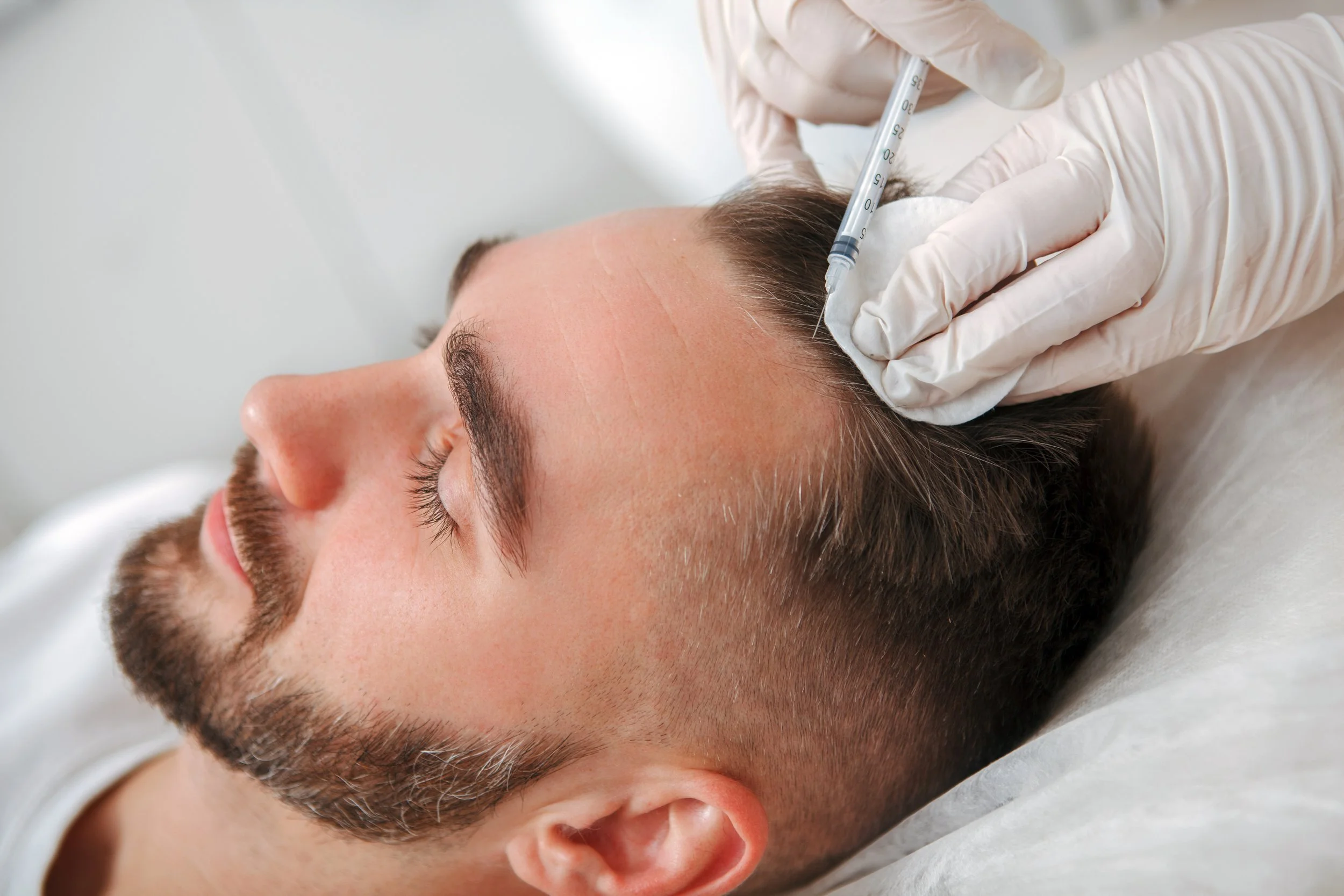 A man is lying on his side with his eyes closed while a healthcare professional, wearing white gloves, administers an injection into his forehead.