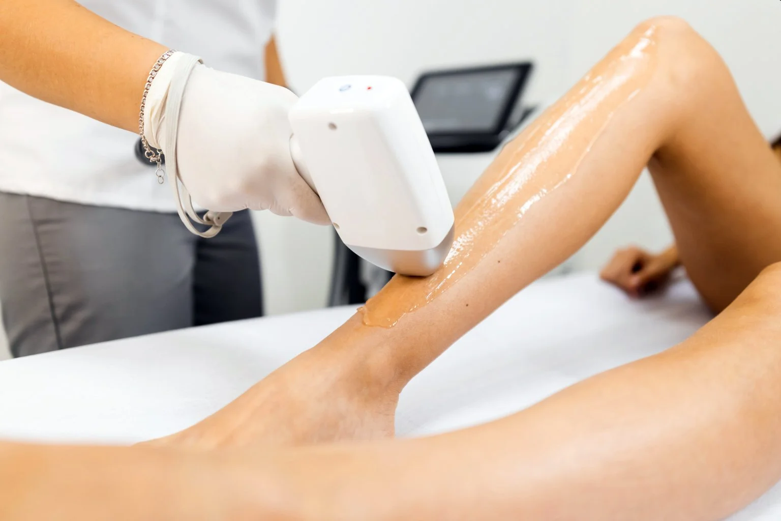 A person receiving a laser hair removal treatment on their arm in a clinical setting.