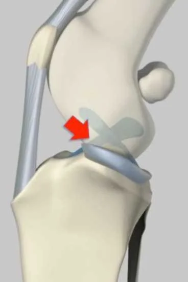 Ligament 1.jpg