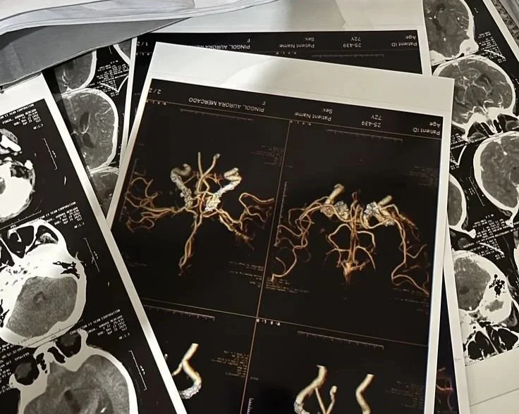 Medical images of brain scans, including MRI or CT images, with some showing detailed blood vessels and brain structures.