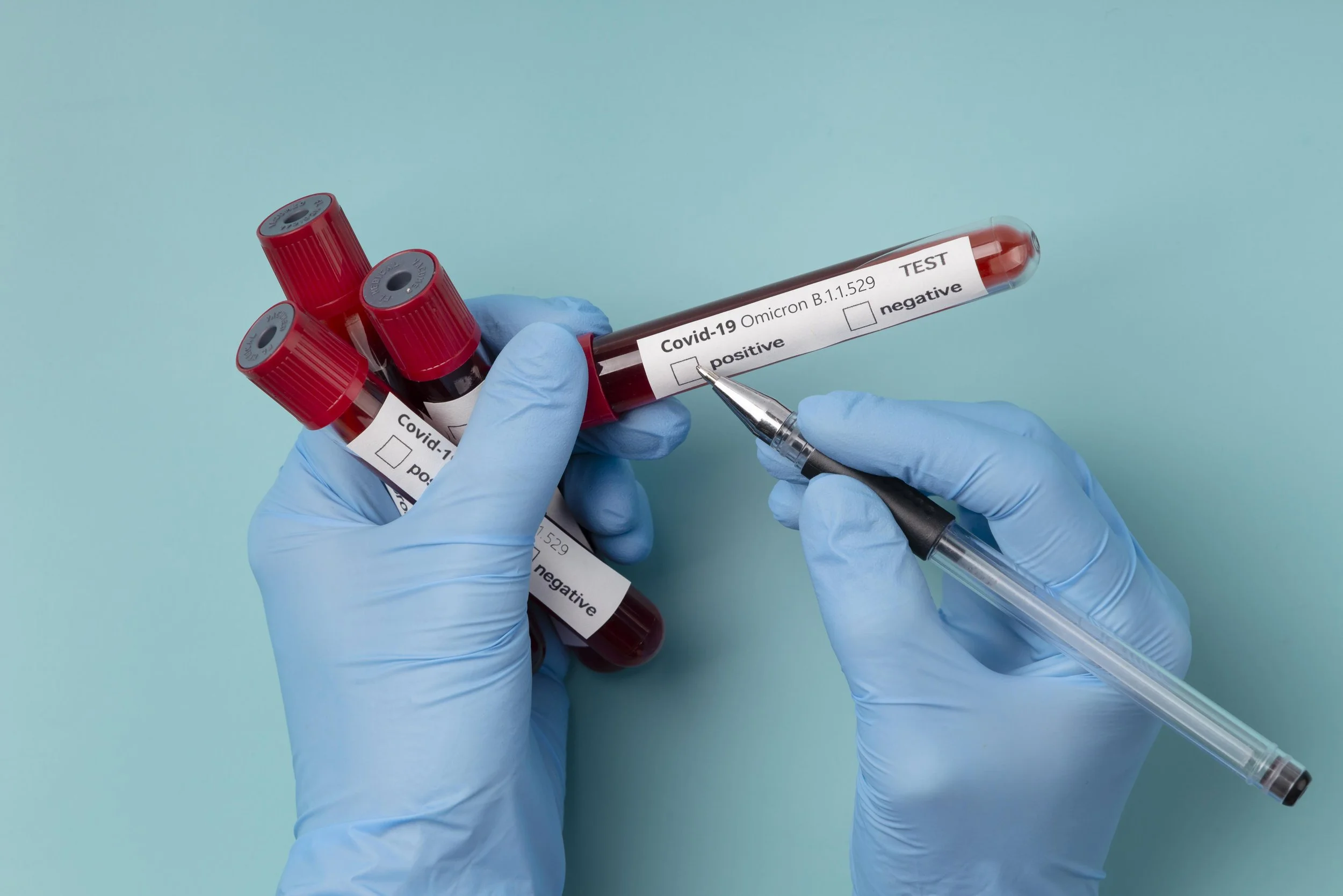 Routine Blood Draw (In Office)