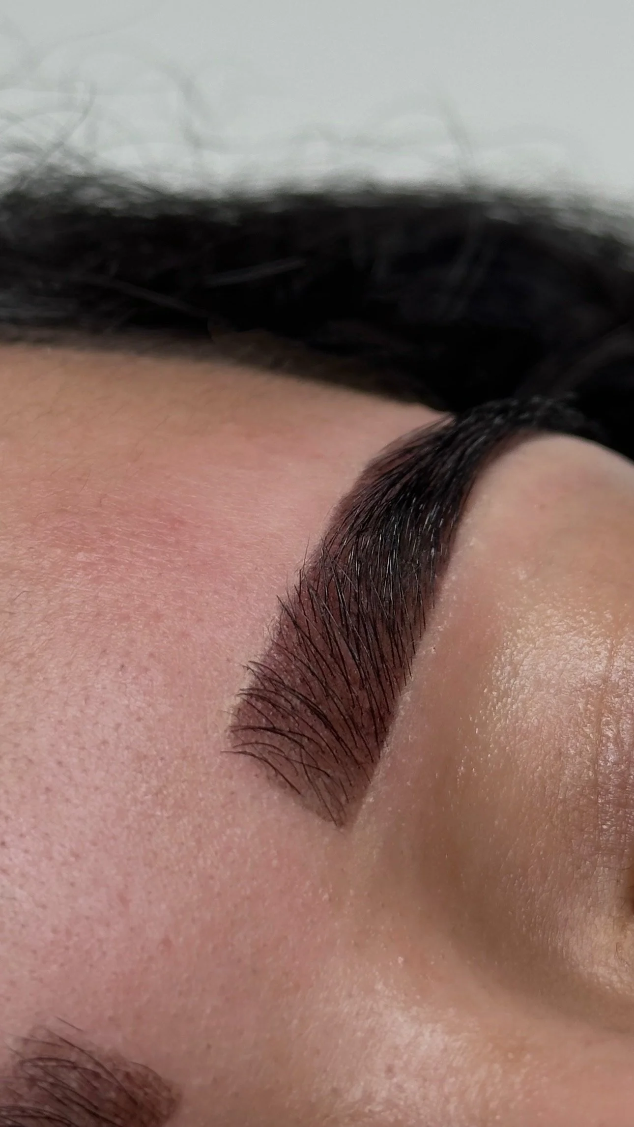 Person lying down and receiving an eyebrow tattooing procedure, with a person wearing purple gloves using surgical tools.