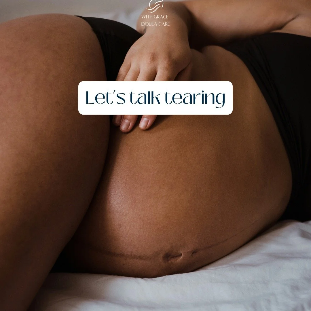 Tearing is one of the biggest fears before birth. The truth is, most tears are minor and heal naturally. But there are some things you can try ahead of the birth to decrease the risk of a severe tear.

Every birth is different, but being prepared can