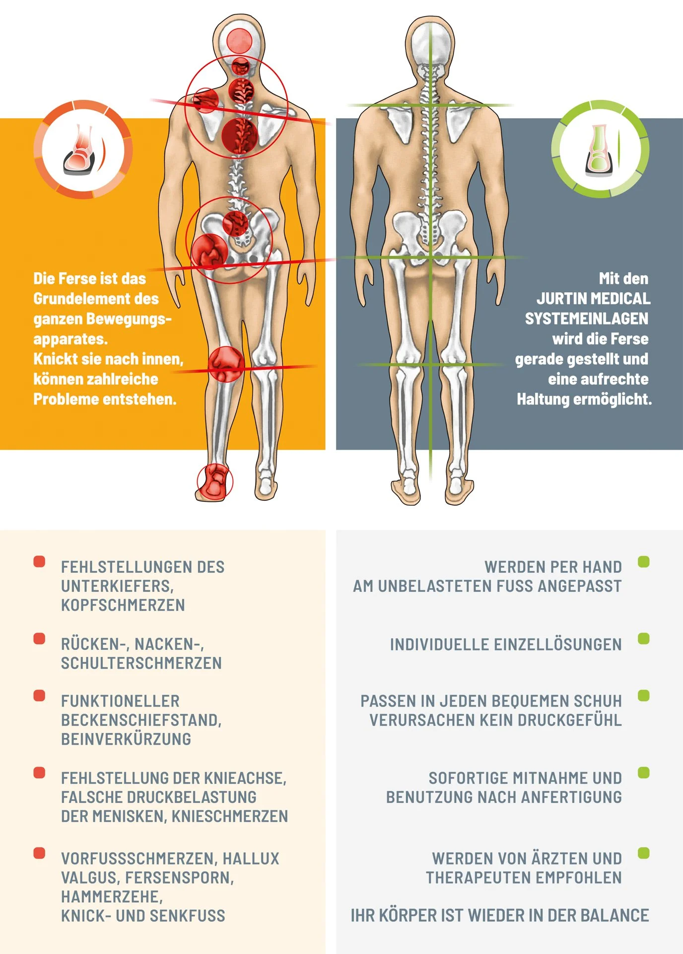 Körperstatik mit JURTIN Systemeinlagen – schematische Darstellung der Korrektur von Fuß-, Knie- und Wirbelsäulenfehlstellungen